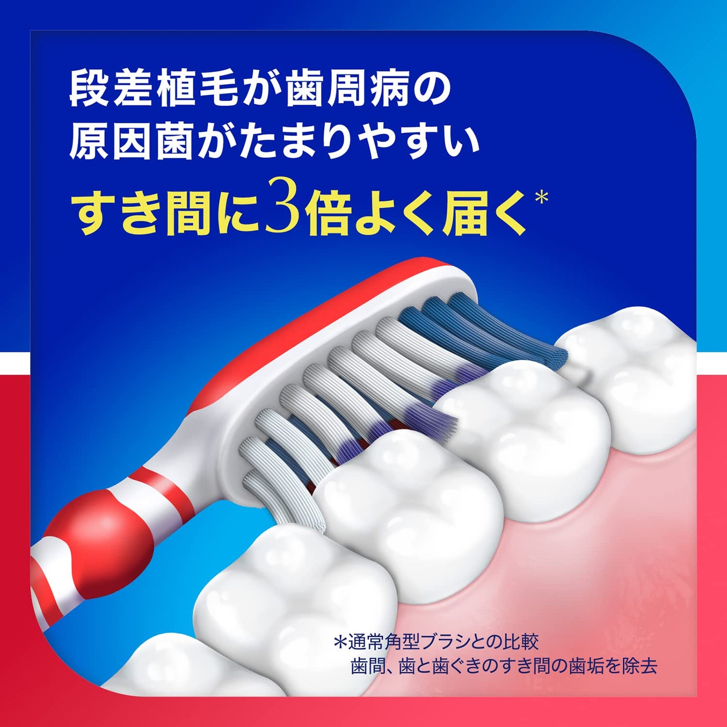 シュミテクト 歯周ダブルケアEXハブラシ レギュラー(ふつう) 1本 容量1ホン歯ブラシ
