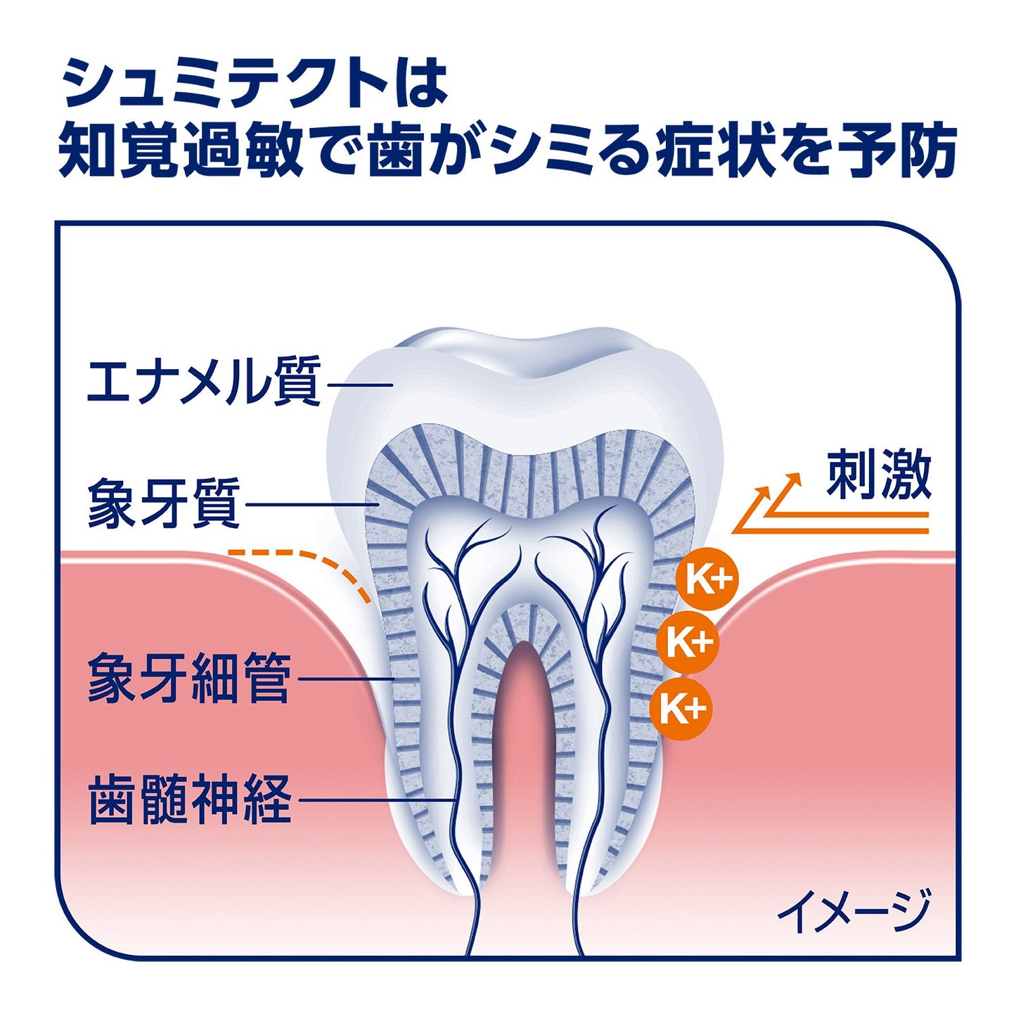 【まとめ買い】薬用シュミテクト 歯周病ケア〈1450ppm〉 22g 容量22G×10点セット グラクソスミスクライン 歯磨き