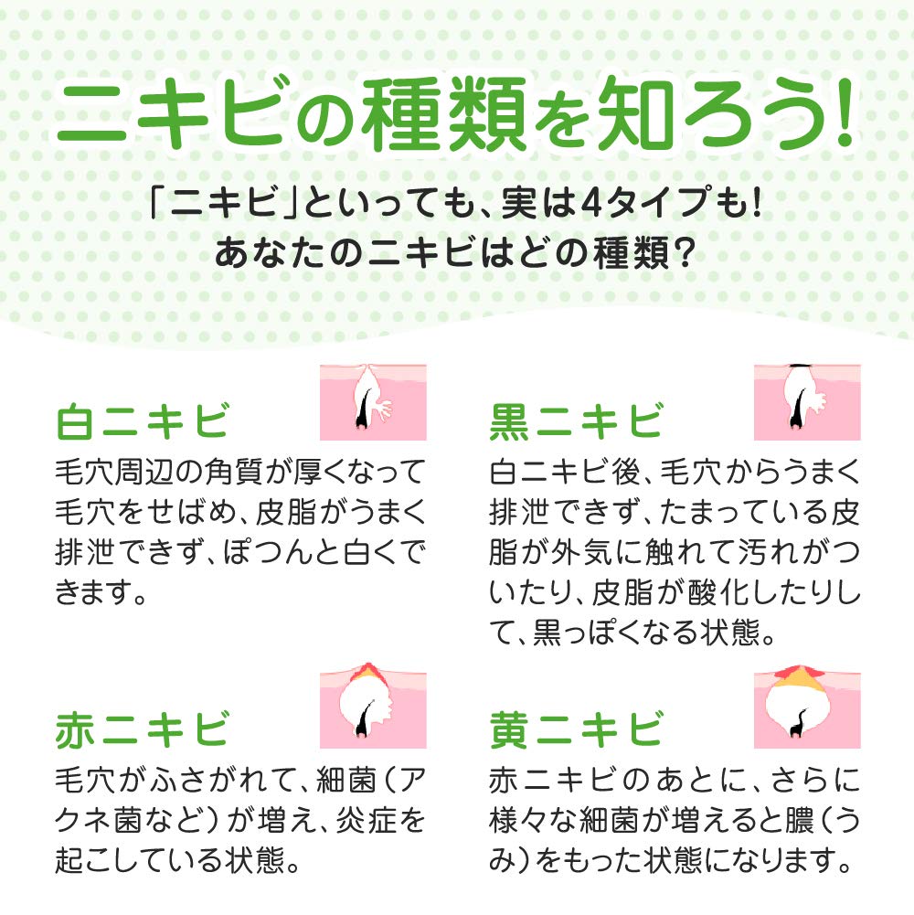 メンソレータム　アクネス　薬用ふわふわな泡洗顔 容量160ML ロート製薬 洗顔・クレンジング