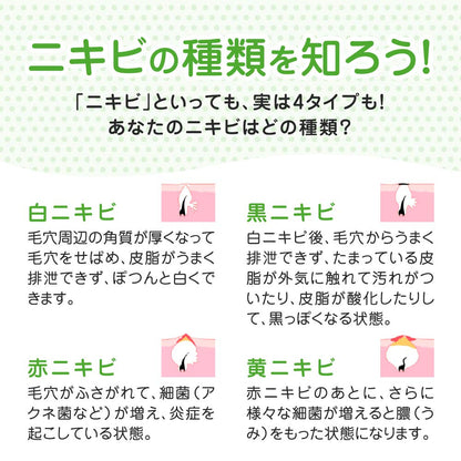 メンソレータム　アクネス　薬用ふわふわな泡洗顔 容量160ML ロート製薬 洗顔・クレンジング