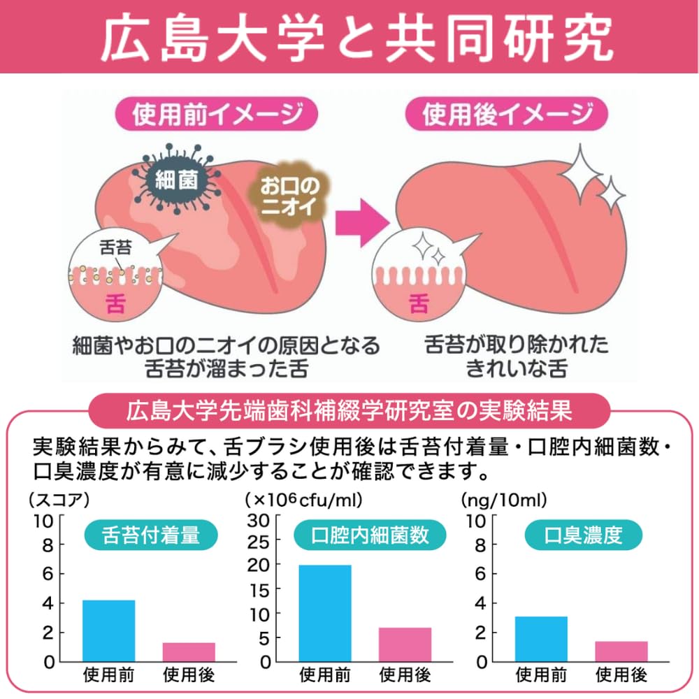 新感覚舌ブラシ「したつつみＮＥＯ」アオミドリ 容量1ｺ 松本金型