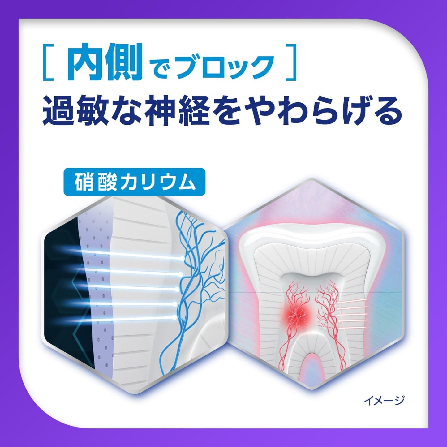 薬用シュミテクト　プラチナプロテクトＥＸ　集中ナイトケア〈１４５０ｐｐｍ〉　３０ｇ 容量30G歯磨き