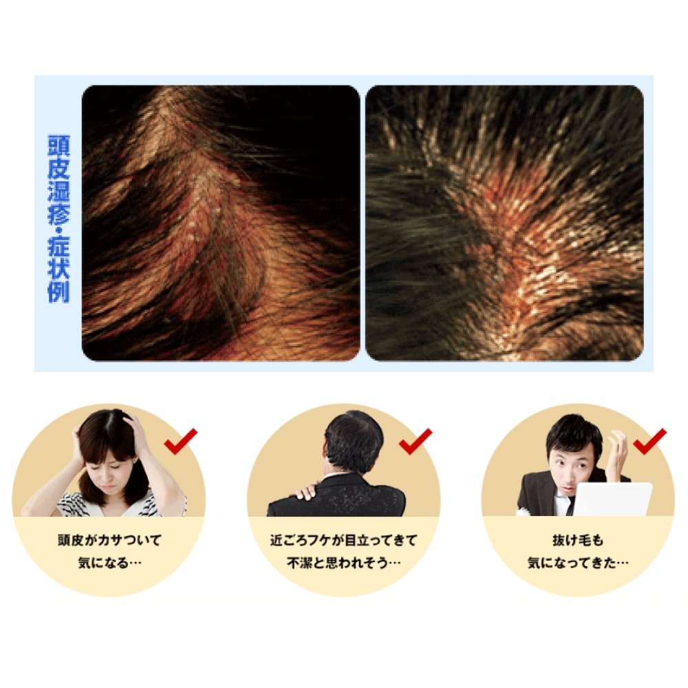 メディクイックＨ　頭皮のメディカルＳＰ　２００ｍｌ 容量200ML ロート製薬 シャンプー