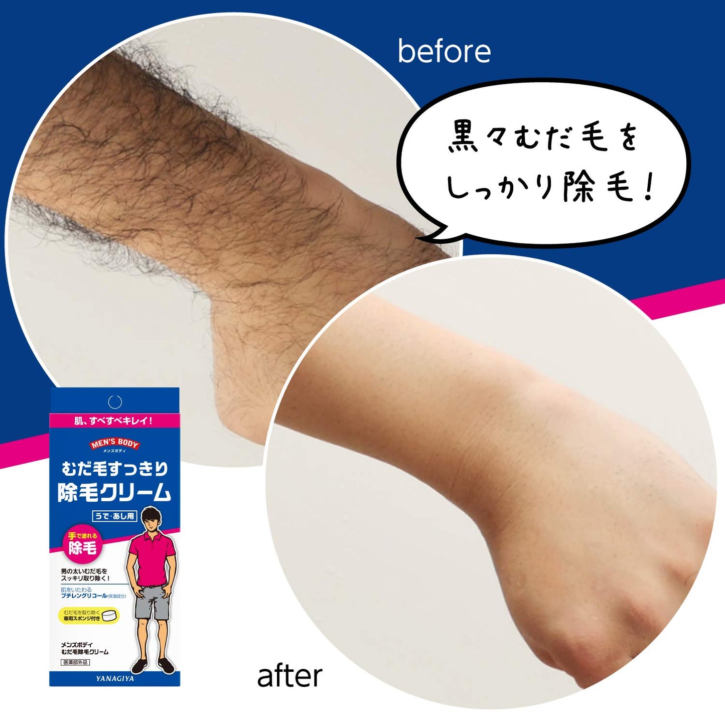 【まとめ買い】メンズボディ　むだ毛除毛クリーム 容量160G×3点セット 柳屋本店 ボディソープ