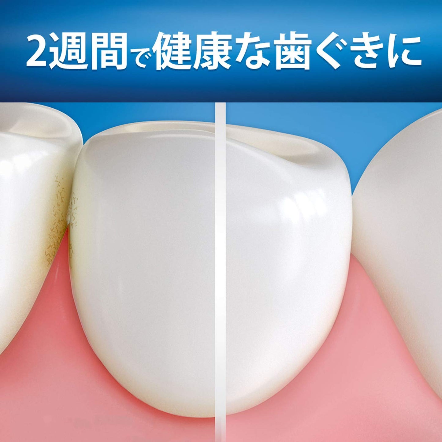 【まとめ買い】オーラルB 歯ぐきケア 超高密度 容量1個×6点セット Ｐ＆Ｇ 歯ブラシ