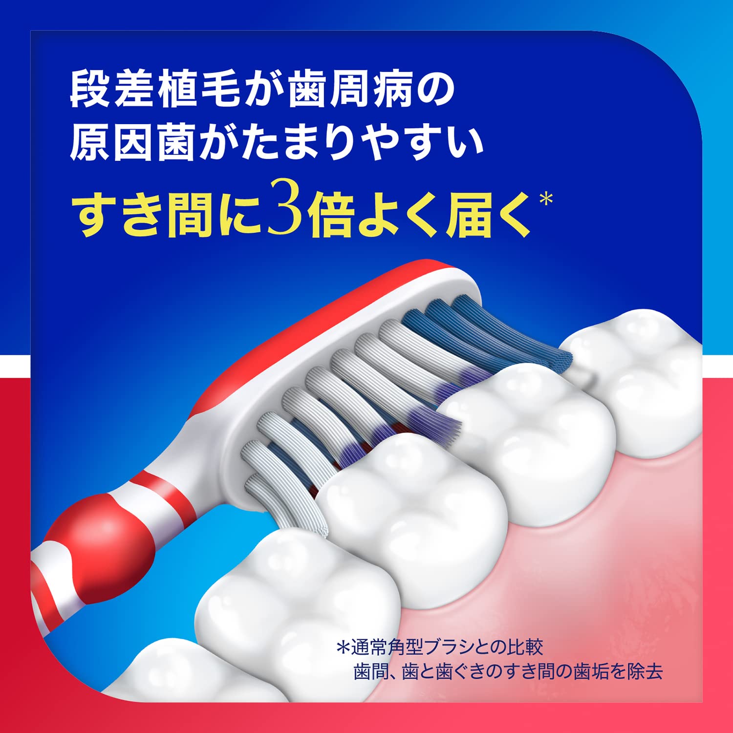 【まとめ買い】シュミテクト　歯周ダブルケアＥＸハブラシ　レギュラー（ふつう）　１本 容量1ホン×12点セット歯ブラシ