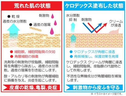 ケロデックスクリーム　チューブタイプ　１００ｇ